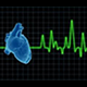 EKG Challange